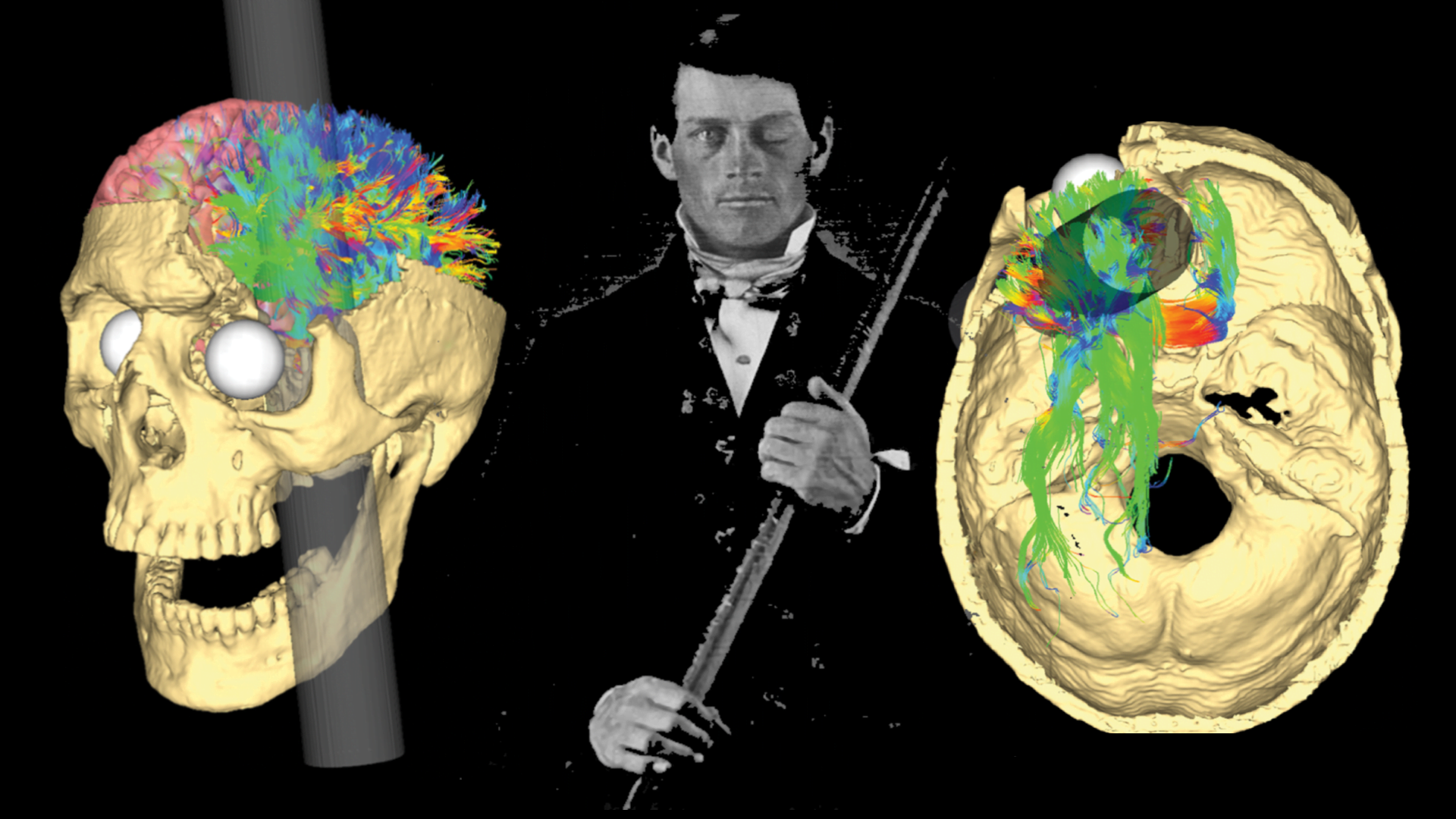 what does the case study of phineas gage teach us